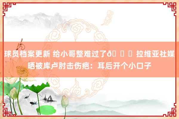 球员档案更新 给小哥整难过了😅拉维亚社媒晒被库卢肘击伤疤：耳后开个小口子