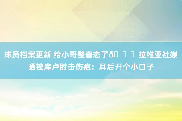 球员档案更新 给小哥整窘态了😅拉维亚社媒晒被库卢肘击伤疤：耳后开个小口子